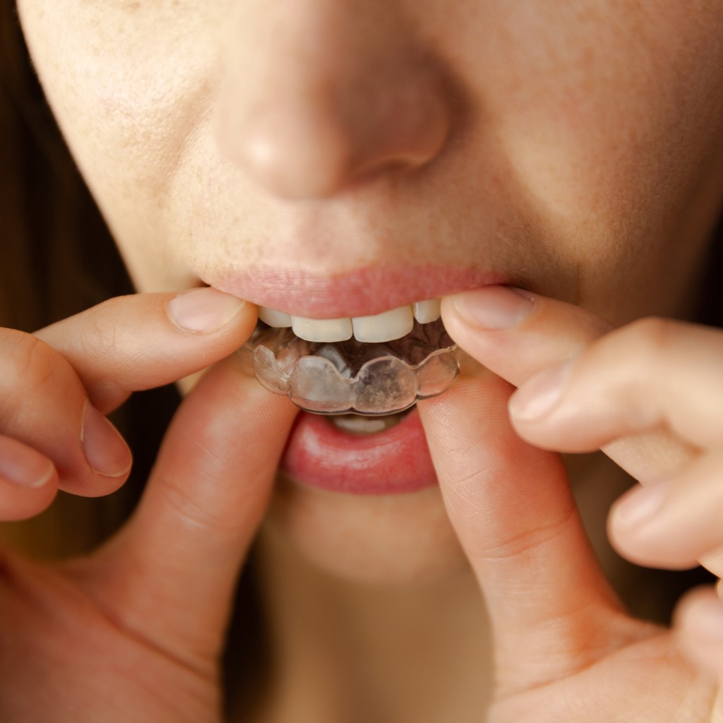 Dental Dentures | Night Guards | Dental Reflections
