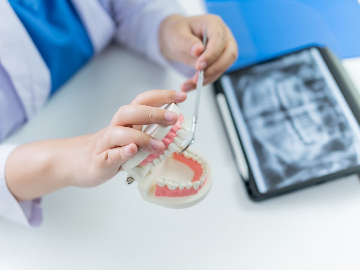 When Is It Time to Replace or Adjust Partial Dentures?