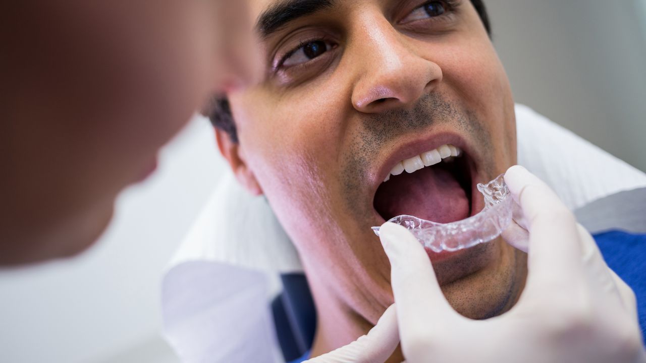 What’s the Right Way to Clean and Store a Dental Night Guard?